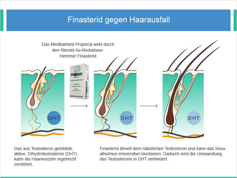 Wirkung von Finasterid